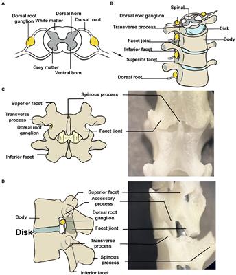 Rapid injection of lumbar dorsal root ganglia under direct vision: Relevant anatomy, protocol, and behaviors